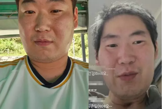 영철
