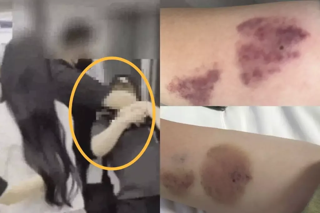 연예인 과잉 경호 논란 관련 상처 이미지
