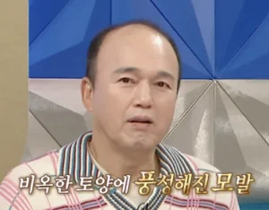 김광규 모발