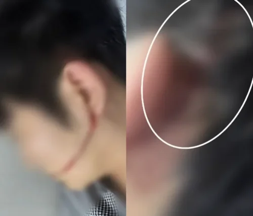 워터건