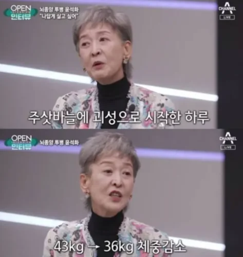 윤석화