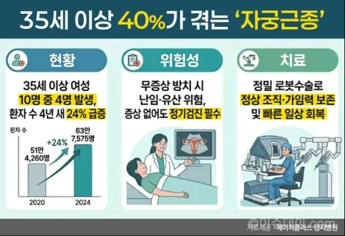자궁근종 환자가 증가하고 있다.