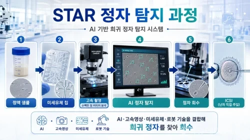 AI 정자 탐지 STAR, 극소량 정자 찾아 출산까지