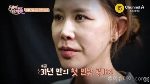 채리나 뷰티클리닉 터치미