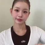 맹승지 인중 축소 수술 후기