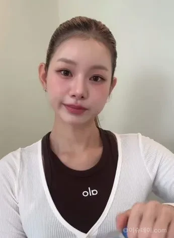 맹승지 인중 축소 수술 후기