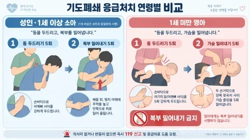 기도폐쇄 응급처치 방법을 연령별로 비교한 교육용 다이어그램