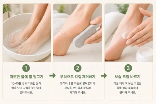 발뒤꿈치 각질을 안전하게 관리하는 3단계 과정 일러스트