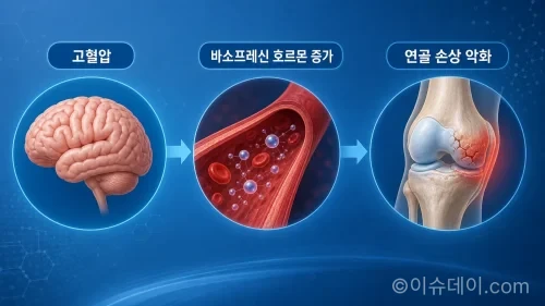 고혈압 골관절염